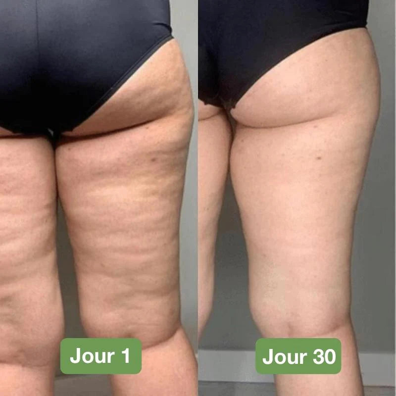 Aspect visuel de la peau avant et après plusieurs semaines de port du legging gainant 3D